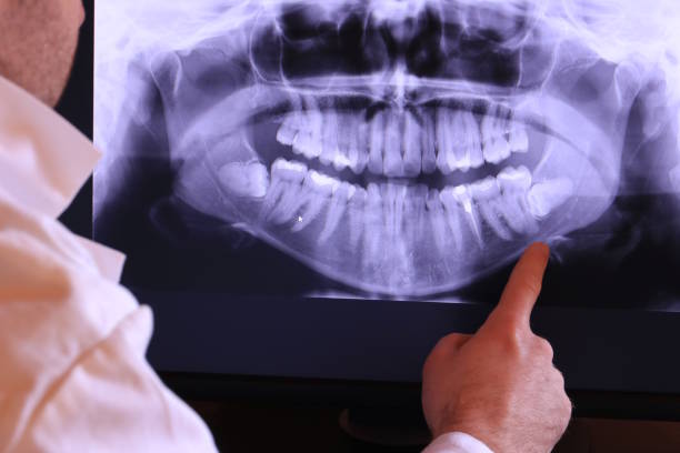 Best Tooth Pain Emergency Relief  in Slinger, WI