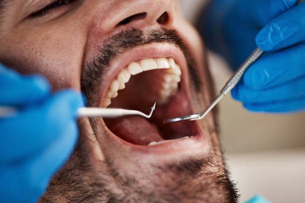 Best Broken Tooth Emergency  in Slinger, WI